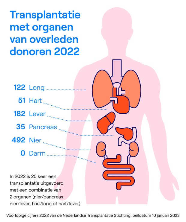 Voorlopige transplantatie organen jaarcijfers 2022