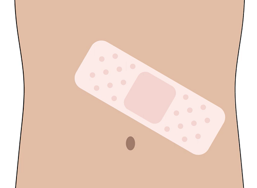 This video explains more about how a donor’s body looks after the donation.