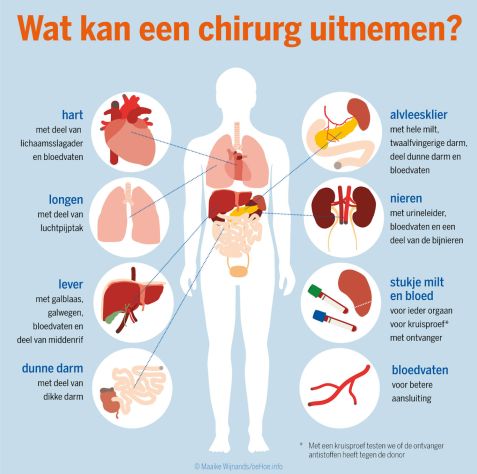 Infographic. Welke organen kan een chirurg uitnemen?